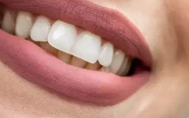 Sonrisa luminosa después de un tratamiento estético